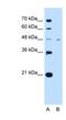 Solute Carrier Family 16 Member 1 antibody, NBP1-59656, Novus Biologicals, Western Blot image 