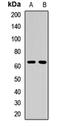5-aminolevulinate synthase, erythroid-specific, mitochondrial antibody, orb412458, Biorbyt, Western Blot image 