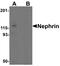 NPHS1 Adhesion Molecule, Nephrin antibody, PA5-72826, Invitrogen Antibodies, Western Blot image 