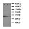 Interferon Regulatory Factor 6 antibody, orb329680, Biorbyt, Western Blot image 