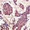 Signal Transducer And Activator Of Transcription 5A antibody, orb11432, Biorbyt, Immunohistochemistry paraffin image 