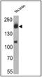 Erb-B2 Receptor Tyrosine Kinase 4 antibody, MA5-12888, Invitrogen Antibodies, Western Blot image 