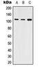 ATPase Sarcoplasmic/Endoplasmic Reticulum Ca2+ Transporting 2 antibody, LS-C353702, Lifespan Biosciences, Western Blot image 