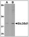 UDP-glucuronic acid/UDP-N-acetylgalactosamine transporter antibody, AP23853PU-N, Origene, Western Blot image 