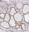 GLIS Family Zinc Finger 3 antibody, NBP2-33787, Novus Biologicals, Immunohistochemistry frozen image 