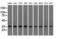 Eukaryotic Translation Initiation Factor 2 Subunit Alpha antibody, LS-C115365, Lifespan Biosciences, Western Blot image 