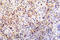 p53 antibody, LS-C178095, Lifespan Biosciences, Immunohistochemistry frozen image 