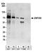Zinc Finger Protein 358 antibody, A304-090A, Bethyl Labs, Western Blot image 