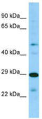 Signal Regulatory Protein Beta 2 antibody, TA334082, Origene, Western Blot image 