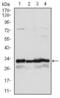 NAD(P)H Quinone Dehydrogenase 1 antibody, GTX60524, GeneTex, Western Blot image 