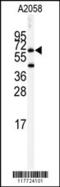 Butyrylcholinesterase antibody, 63-222, ProSci, Western Blot image 