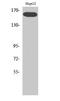 Kinase Insert Domain Receptor antibody, STJ90271, St John