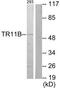 TNF Receptor Superfamily Member 11b antibody, TA314298, Origene, Western Blot image 