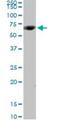 Cytochrome P450 Family 4 Subfamily V Member 2 antibody, H00285440-D01P, Novus Biologicals, Western Blot image 