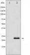 TIMP Metallopeptidase Inhibitor 1 antibody, abx012249, Abbexa, Western Blot image 