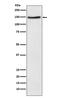 NPC1 Like Intracellular Cholesterol Transporter 1 antibody, M01954, Boster Biological Technology, Western Blot image 