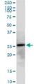 Adenylate Kinase 3 antibody, H00050808-B01P, Novus Biologicals, Western Blot image 