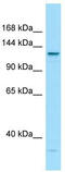 Laminin Subunit Gamma 3 antibody, TA338136, Origene, Western Blot image 