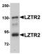 SEC16 Homolog B, Endoplasmic Reticulum Export Factor antibody, NBP1-77122, Novus Biologicals, Western Blot image 