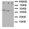 CD1a Molecule antibody, orb97002, Biorbyt, Western Blot image 