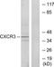 C-X-C Motif Chemokine Receptor 3 antibody, TA313938, Origene, Western Blot image 