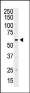 Phosphatidylinositol 4-Kinase Type 2 Alpha antibody, MBS9212614, MyBioSource, Western Blot image 