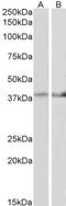 Isocitrate Dehydrogenase (NAD(+)) 3 Beta antibody, NBP1-78787, Novus Biologicals, Western Blot image 