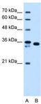 Aldose reductase antibody, TA346556, Origene, Western Blot image 
