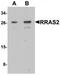 RAS Related 2 antibody, TA319836, Origene, Western Blot image 