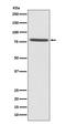 Ezrin antibody, M01750, Boster Biological Technology, Western Blot image 