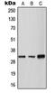 Tryptase Gamma 1 antibody, LS-C353371, Lifespan Biosciences, Western Blot image 