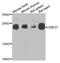 Ubiquitin Conjugating Enzyme E2 T antibody, PA5-76202, Invitrogen Antibodies, Western Blot image 