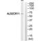 C2 Calcium Dependent Domain Containing 6 antibody, PA5-49977, Invitrogen Antibodies, Western Blot image 