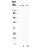 LIF Receptor Subunit Alpha antibody, R32098, NSJ Bioreagents, Western Blot image 