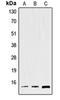 Trefoil Factor 2 antibody, orb214658, Biorbyt, Western Blot image 