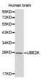 Ubiquitin Conjugating Enzyme E2 K antibody, abx001009, Abbexa, Western Blot image 