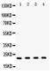 PTTG1 Regulator Of Sister Chromatid Separation, Securin antibody, PA2240, Boster Biological Technology, Western Blot image 