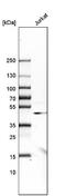 ASA antibody, NBP1-86135, Novus Biologicals, Western Blot image 