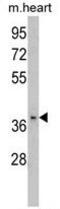 Fructose-Bisphosphatase 2 antibody, GTX81753, GeneTex, Western Blot image 