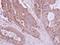 Huntingtin Interacting Protein 1 Related antibody, GTX117072, GeneTex, Immunohistochemistry paraffin image 