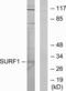 SURF1 Cytochrome C Oxidase Assembly Factor antibody, LS-B9956, Lifespan Biosciences, Western Blot image 