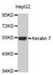 Keratin 7 antibody, MBS125806, MyBioSource, Western Blot image 