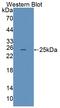 LDL Receptor Related Protein 2 antibody, abx130942, Abbexa, Western Blot image 