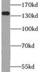Ubiquitin Specific Peptidase 25 antibody, FNab09321, FineTest, Western Blot image 