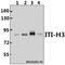 Inter-Alpha-Trypsin Inhibitor Heavy Chain 3 antibody, A07339-1, Boster Biological Technology, Western Blot image 