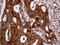 Ribosome Binding Protein 1 antibody, M07074, Boster Biological Technology, Immunohistochemistry paraffin image 