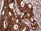 Ribosome-binding protein 1 antibody, M07074, Boster Biological Technology, Immunohistochemistry paraffin image 