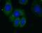 Ribosomal Protein L18a antibody, FNab07417, FineTest, Immunofluorescence image 