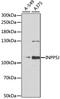 Inositol Polyphosphate-5-Phosphatase J antibody, 22-365, ProSci, Western Blot image 