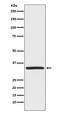 TNFRSF1A Associated Via Death Domain antibody, M02785, Boster Biological Technology, Western Blot image 